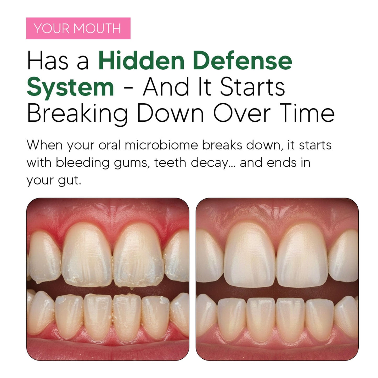 Oral Defence — Finally fix bad breath, bleeding gums & tonsil stones — at the source